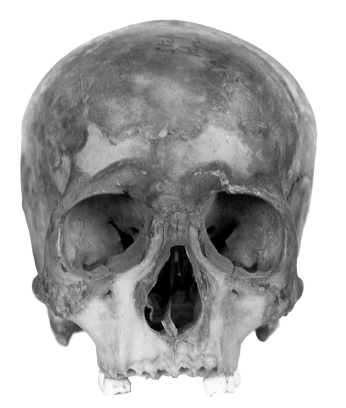 Identification of Royal Skeletal Remains from Egyptian Pyramids